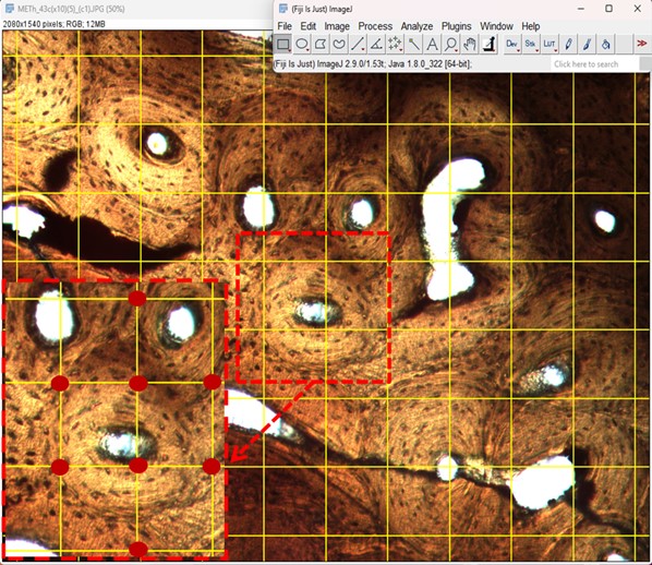 Figure 2. A micro-image (magnification X100) of a cremated femur bone presenting the applied methodology for age-at-death estimation.